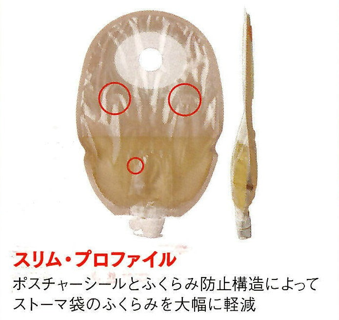 ノバライフ2 ウロストミー